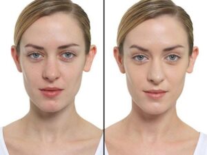 Read more about the article Best Cream for Fair Skin Without Hydroquinone